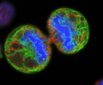 Melanoma cell dividing 
